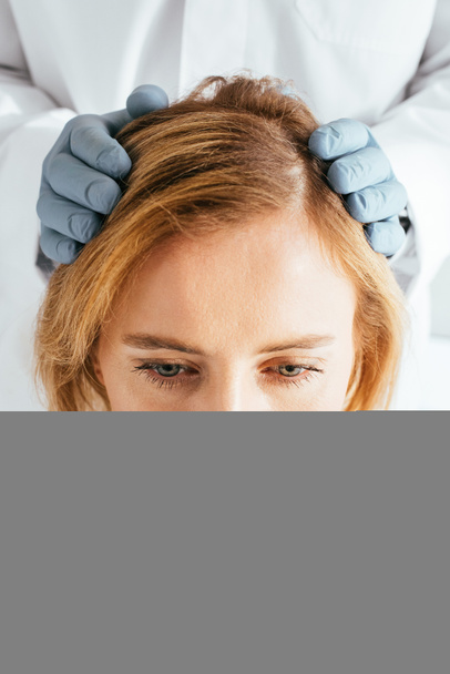 nyírt kilátás bőrgyógyász a latex kesztyű vizsgáló haj a beteg  - Fotó, kép