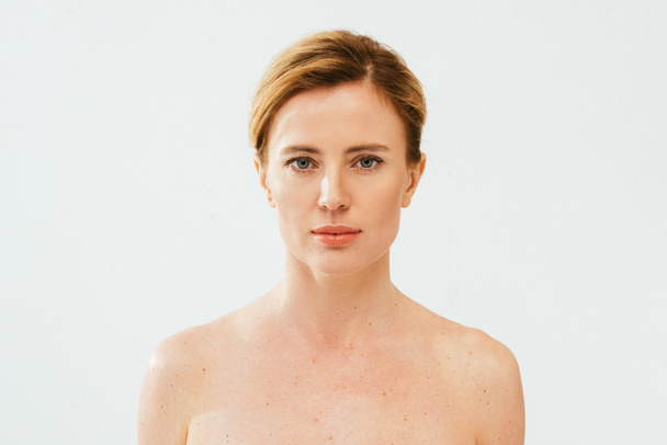 白いカメラを見て皮膚の病気を持つ裸の病気の女性  - 写真・画像