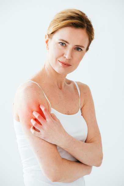 ελκυστική αλλεργική γυναίκα ξύσιμο κόκκινο δέρμα σε λευκό  - Φωτογραφία, εικόνα