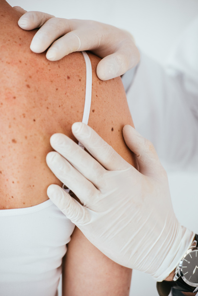vista recortada de dermatólogo en guantes de látex blanco examinando mujer con enfermedad de la piel aislada en blanco
  - Foto, Imagen