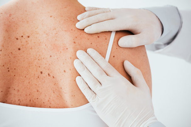 vista recortada de dermatólogo en guantes de látex examinando mujer con enfermedad de la piel aislada en blanco
  - Foto, Imagen