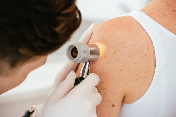vista recortada del dermatólogo en guantes de látex que sostienen el dermatoscopio mientras examina al paciente con enfermedad de la piel
   - Foto, Imagen