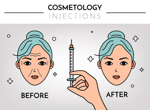 Cosmetic injections. Infographics before and after. Vector flat illustration with place for text. Mesotherapy, rejuvenation. - Vector, Image