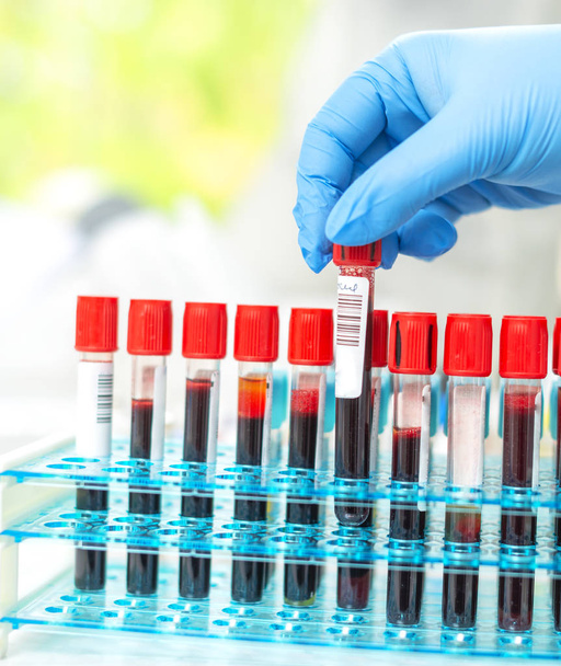 lekarz rękę biorąc probówki krwi z szafy z maszynami analizy w tle laboratoryjnym/technika trzymania badania rur krwi w laboratorium badawczym - Zdjęcie, obraz