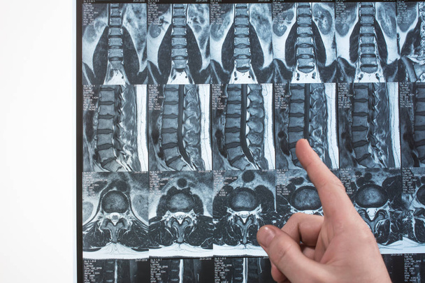 La main du médecin montre quelque chose sur les résultats d'IRM (résonance magnétique t
 - Photo, image