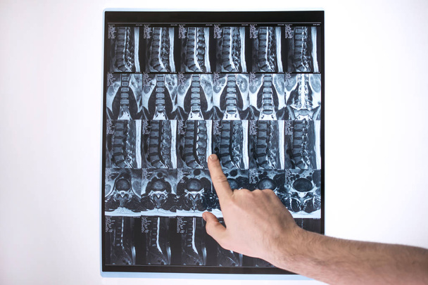Γιατρός χέρι δείχνει κάτι για τη μαγνητική τομογραφία αποτελέσματα (μαγνητική συντονισμού t - Φωτογραφία, εικόνα