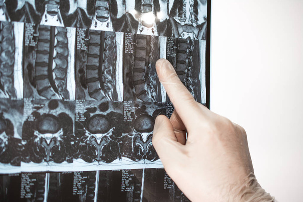 La main du médecin montre quelque chose sur les résultats d'IRM (résonance magnétique t
 - Photo, image