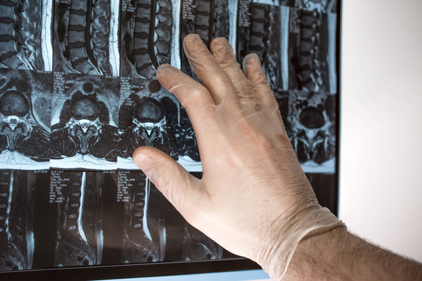 Doctor hand shows something on MRI results (magnetic resonance t - Fotoğraf, Görsel