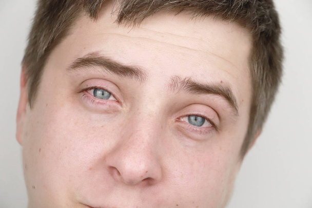 Oftalmología, alergias, desgarros. Retrato de un hombre que está llorando
 - Foto, imagen
