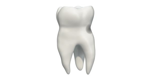 Ząb z próchnicą, animacja 3D. Renderowanie 3D na białym tle - Materiał filmowy, wideo