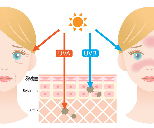 γραφική απεικόνιση της διαφοράς μεταξύ των ακτίνων UVA και UVB. Διείσδυση UV στο ανθρώπινο δέρμα και λευκή γυναίκα πρόσωπο. φροντίδα του δέρματος και την αίσθηση της ομορφιάς - Διάνυσμα, εικόνα