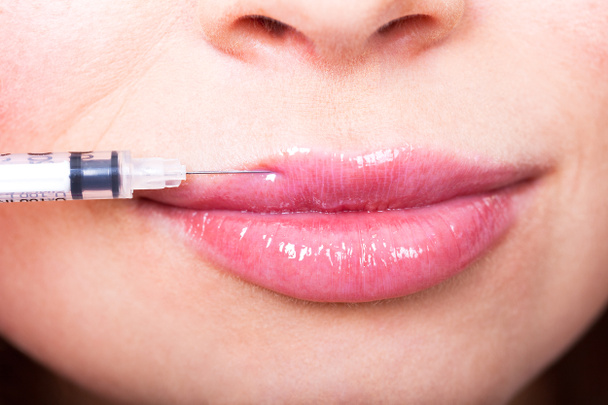 女性の唇と注射器のクローズアップショット - 写真・画像