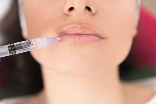 Close up of female lips injected with medical substance with syringe - 写真・画像