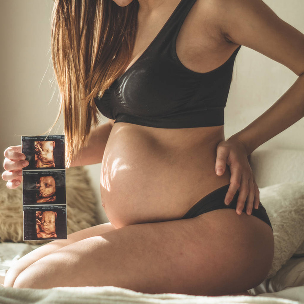 Těhotná žena, která drží Ultrazvukový obraz. Koncept těhotenství, zdravotní péče, gynekologie, medicína - Fotografie, Obrázek