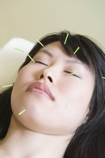 Asian woman with acupuncture needles in her face eyes closed - Photo, Image