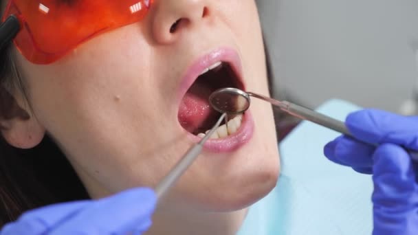 Dentysta bada pacjentów ząb z czarnej jamy na nim za pomocą narzędzi dentystycznych i lustro. - Materiał filmowy, wideo