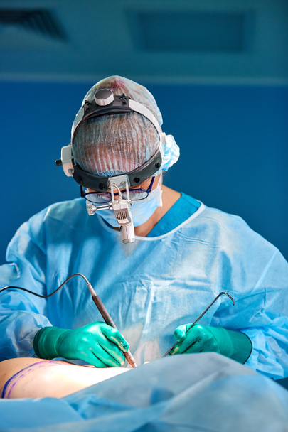 Cerrah hastane ameliyathanesinde estetik ameliyat yapıyor. Tıbbi gelişim sırasında maske takan bir cerrah. Göğüs büyütme. - Fotoğraf, Görsel