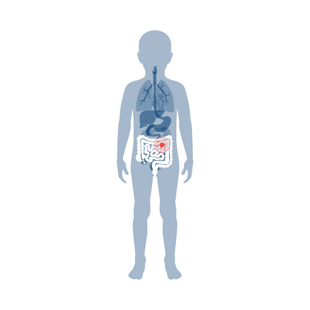 大腸と小腸のベクトル図 - ベクター画像