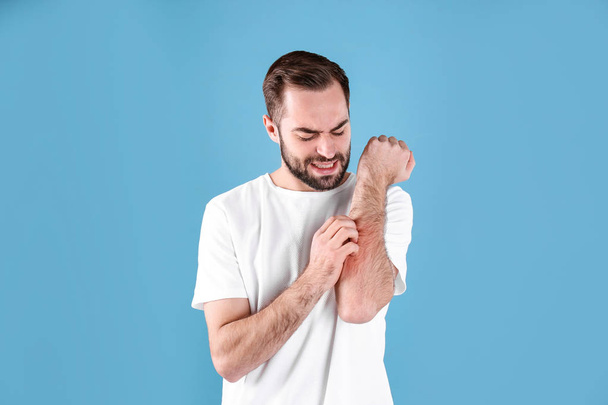 Young man scratching hand on color background. Allergies symptoms - Foto, Imagen