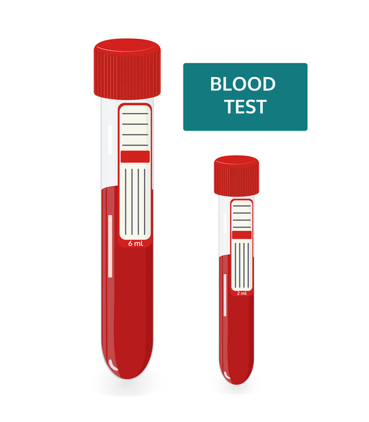 Blood test in tube - Vector, Image