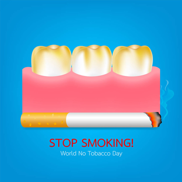 Зуби з сигаретою. Куріння впливає на людські зуби. Концепція стоматологічної допомоги. Кинути палити, світ не тютюновий день. Ілюстрація на синьому фоні. - Вектор, зображення