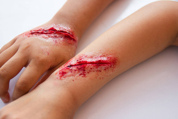 Falso ferimentos nos braços das crianças vestir a ferida efeito especial
 - Foto, Imagem