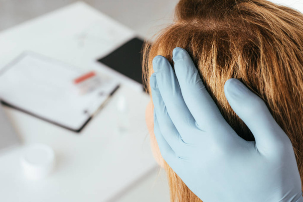 クリニックで患者の髪を調べる青いラテックス手袋の皮膚科医のトリミングビュー  - 写真・画像
