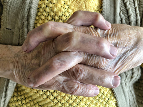 primer plano las manos arrugadas de una persona mayor - Foto, imagen