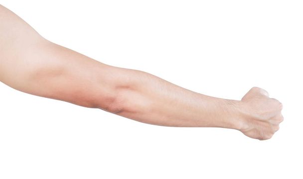Man arm with blood veins on white background, health care and medical concept - Photo, Image