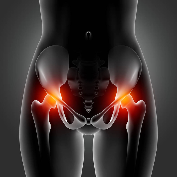 股関節の骨が強調表示された3D女性の医療フィギュア - 写真・画像