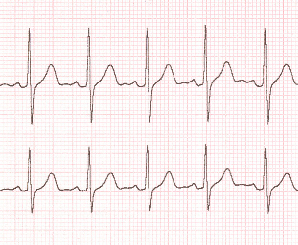 kardiogram - Zdjęcie, obraz