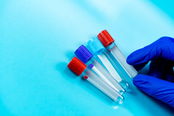 Hand dragen van blauwe handschoenen die flessen voor monsters gebruikt in ziekenhuizen of Geneeskunde voor bloedmonsters in een laboratorium op blauwe achtergrond - Foto, afbeelding