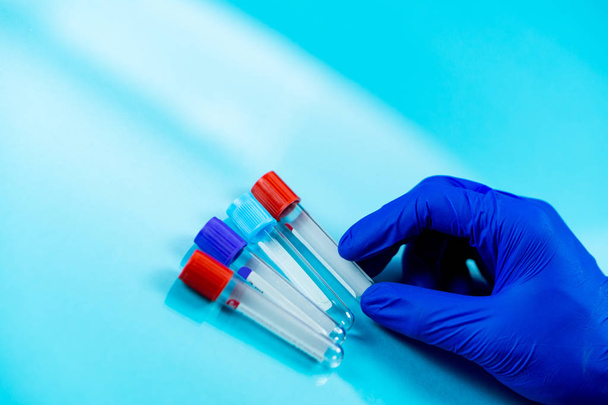 Hand wearing blue gloves holding bottles for samples used in hospitals or medicine for blood samples in a laboratory on a blue background - Φωτογραφία, εικόνα