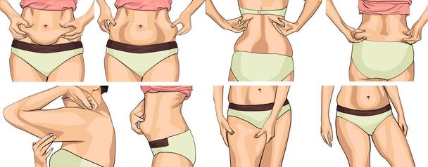set women with fat belly. The girl clamps the fold of the belly with both hands. Female hands touching her fat on body. - Vector, Image