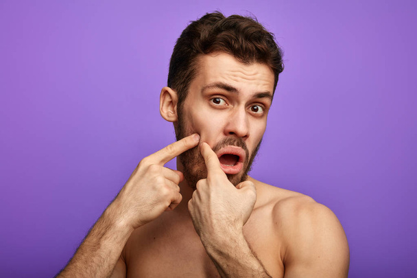 funny man picking the pimple on his cheek - Foto, immagini