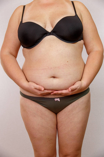 obesity woman in underwear - Φωτογραφία, εικόνα