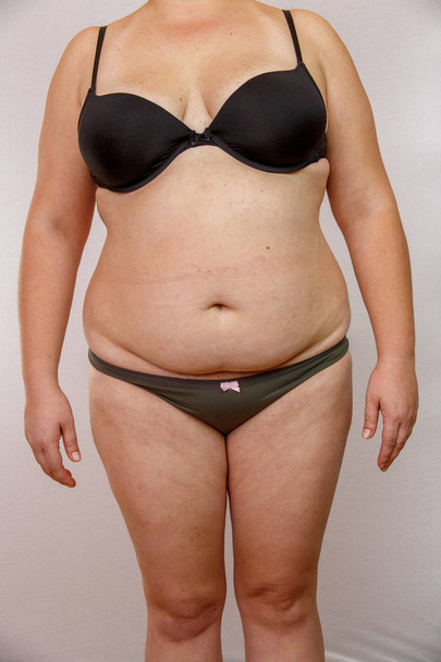 otyłości Kobieta w bieliźnie - Zdjęcie, obraz