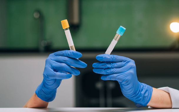 A rubber-gloved hands holds two test tube with the drug - Photo, Image
