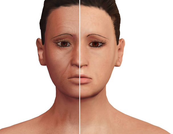 antes y después del proceso estético de rejuvenecimiento después de la terapia PRP. Tratamiento dermatológico facial
 - Foto, imagen