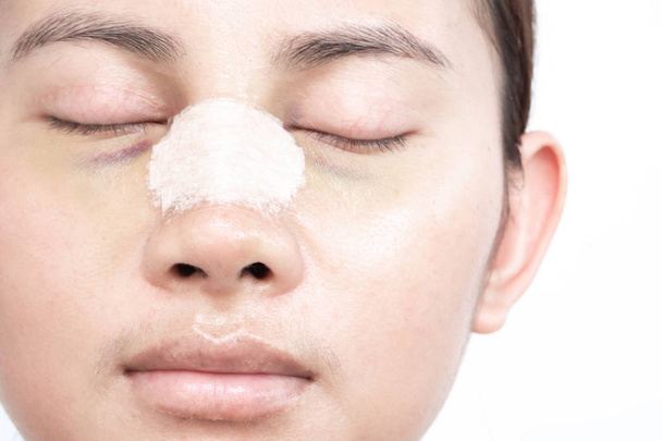 Крупный план лица азиатской женщины с пластической хирургии носа для красоты и косметической концепции, белый фон
 - Фото, изображение