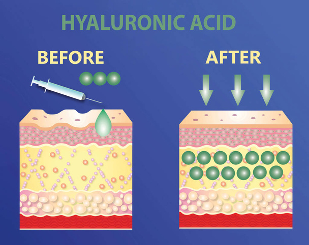 Hyaluronzuur. huidverzorgingsproducten. huidverjonging - Foto, afbeelding