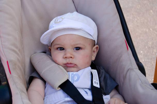 Schattige zes maanden oude baby Bou in de kinderwagen wih muggenbeten op zijn gezicht - Foto, afbeelding