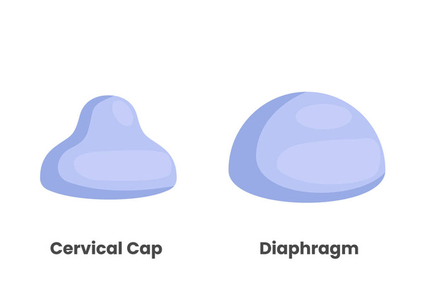 Diafragma en cervicale dop - Vector, afbeelding