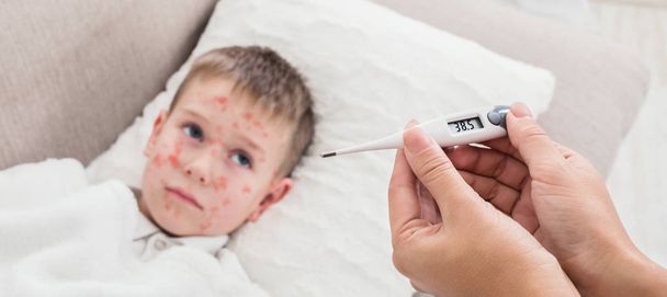 Masernvirus mit hohem Fieber. Mutter misst Temperatur ihres Sohnes - Foto, Bild