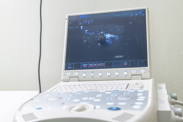 Ультразвукова машина для сканування щитовидної залози
 - Фото, зображення