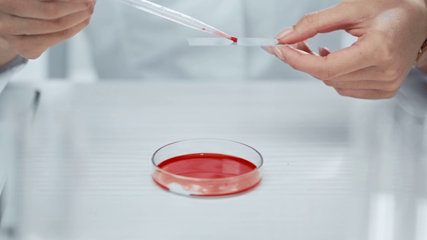 bijgesneden beeld van wetenschapper die bloedmonsters neemt op glas - Video