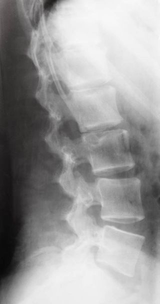 vista de la columna vertebral humana en la imagen de rayos X
 - Foto, imagen