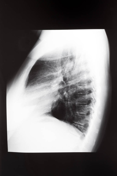 vue latérale du thorax humain avec poumons
 - Photo, image