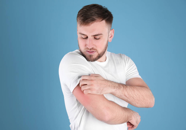 Man scratching arm on color background. Allergy symptoms - Foto, Imagem