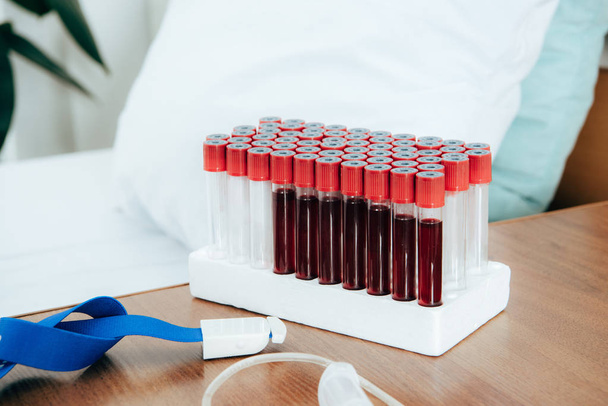 torniquete e tubos de ensaio com sangue perto da cama na clínica
 - Foto, Imagem